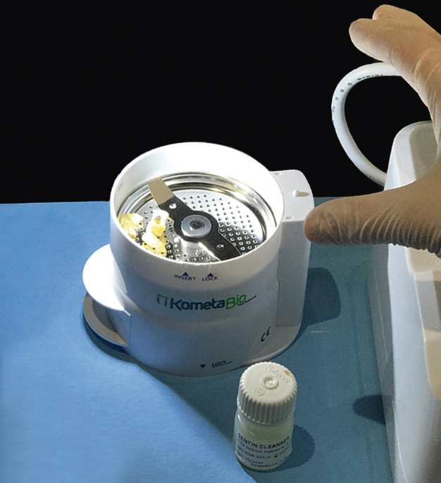 Abb. 4: Im Champions Smart Grinder wird der Zahn zerkleinert.