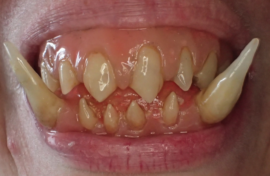 Ein sehr ästhetischer Anblick ... für einen jungen Ork.