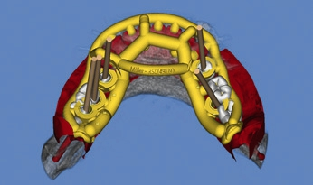 Abb. 5: Die Konstruktion der Schiene.