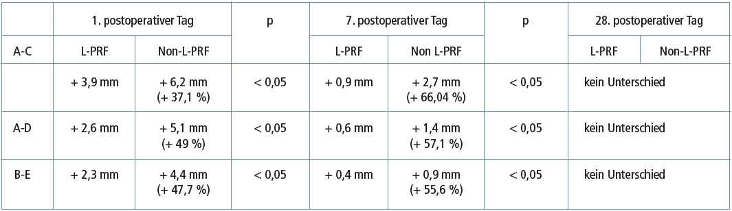 Tab. 1: Postoperative Schwellung im Vergleich zum Ausgangswert. A-C = Strecke Mitte des Tragus – Mundwinkel, A-D = Strecke Mitte des Tragus – Kinnspitze (Pogonion), B-E = Strecke lateraler Augenwinkel – Kieferwinkel