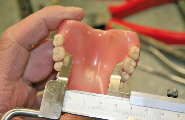 Abb. 2d: Zungenfreiraum: Abstandsmessung 16-26.