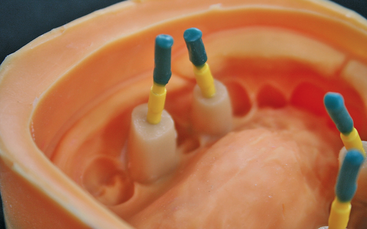 Abb. 12: Kunststoffstümpfe vor dem Ausgießen mit Gips in der Silikonform.