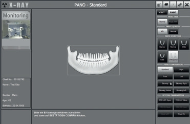 Abb. 5: Parametereinstellungen am Monitor in byzz.