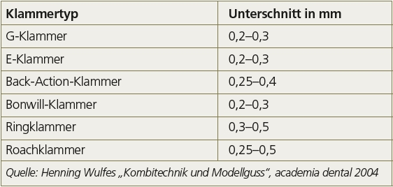 Tab. 1: Hinweise zu Modellgussklammern.