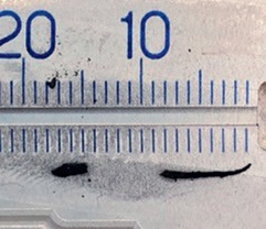 Abb. 5: Entfernter Silberstift und Fragment Radixanker.
