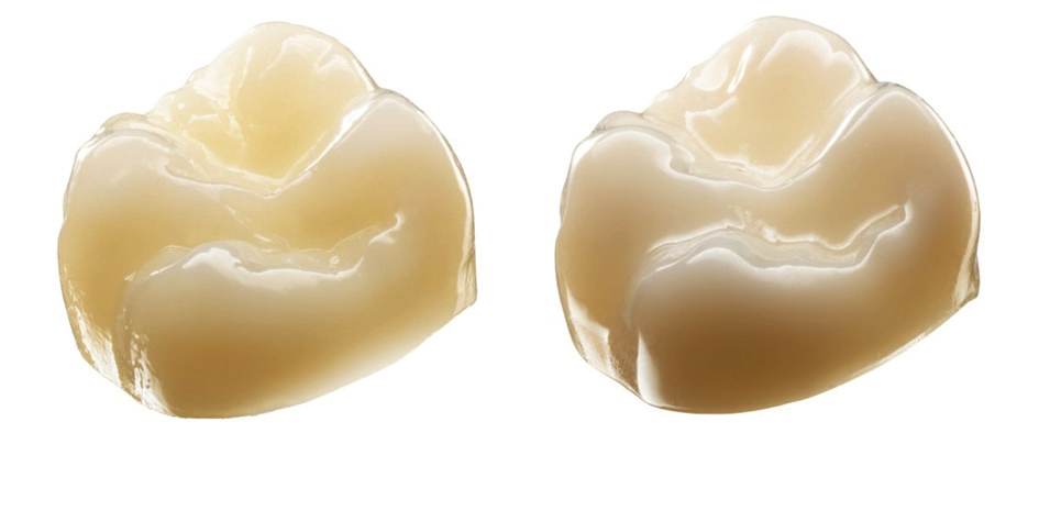 Abb. 3: Krone aus Lava Esthetic Zirkoniumoxid (links) und Lava Plus Zirkoniumoxid (rechts) im Durchlicht: Der Unterschied in der Transluzenz ist deutlich erkennbar.
