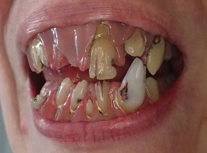 Ein alter Ork – iiiiihhh!