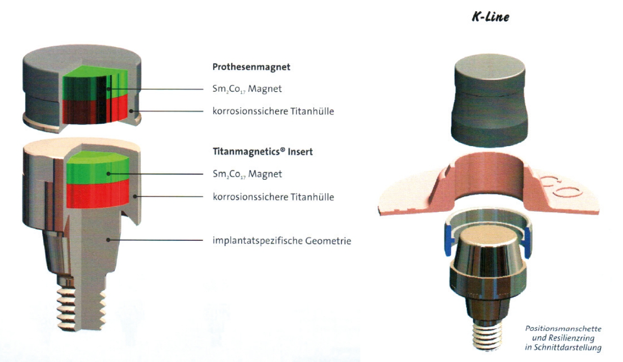 Abb. 5: Konstruktionsmerkmale des steco-Magnetsystems und die K-Line mit dem konischen Primärmagneten.