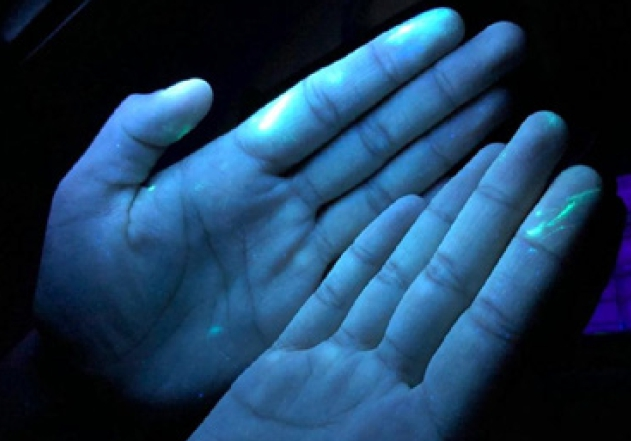 Abb. 4: Undichter Handschuh.