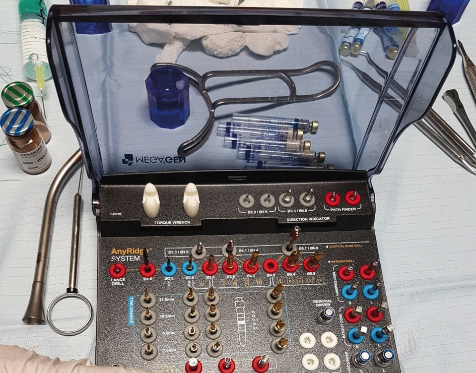 Abb. 5: Chirurgiebox mit Bohrstopps.