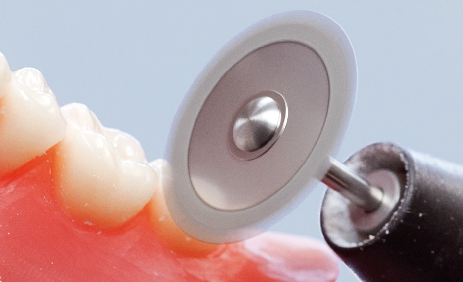 Abb. 4b: ... z. B. für das Separieren der interdentalen Bereiche.