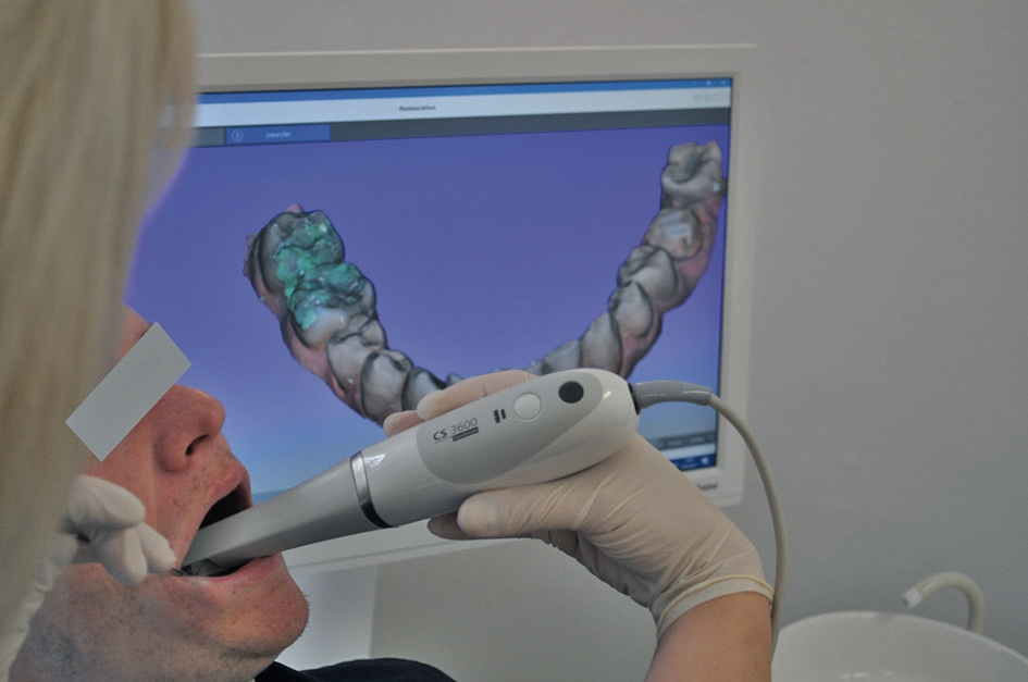 Abb. 5b: Der Intraoralscanner CS 3600 kann dank des Anschlusses über einen USB-Port auch ohne Cart einfach und mobil eingesetzt werden.