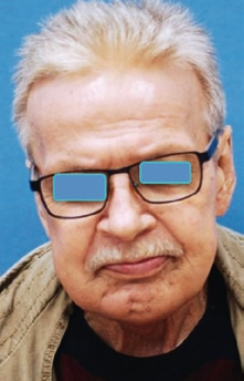 Abb. 9: 65-jähriger Patient.