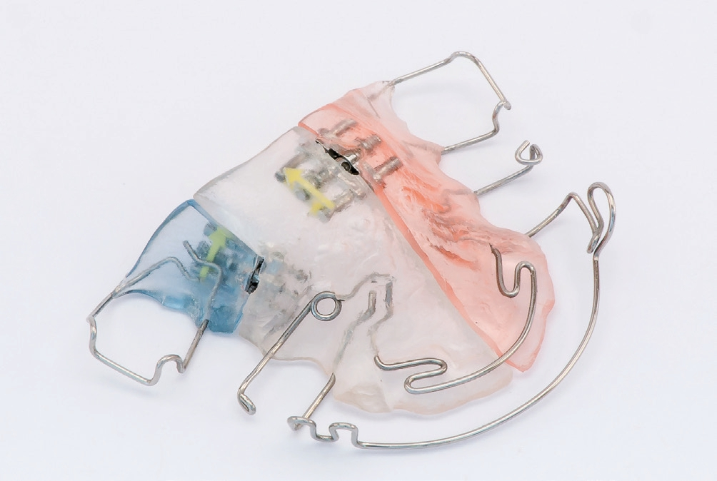 Abb. 43a: OK-Platte von basal.