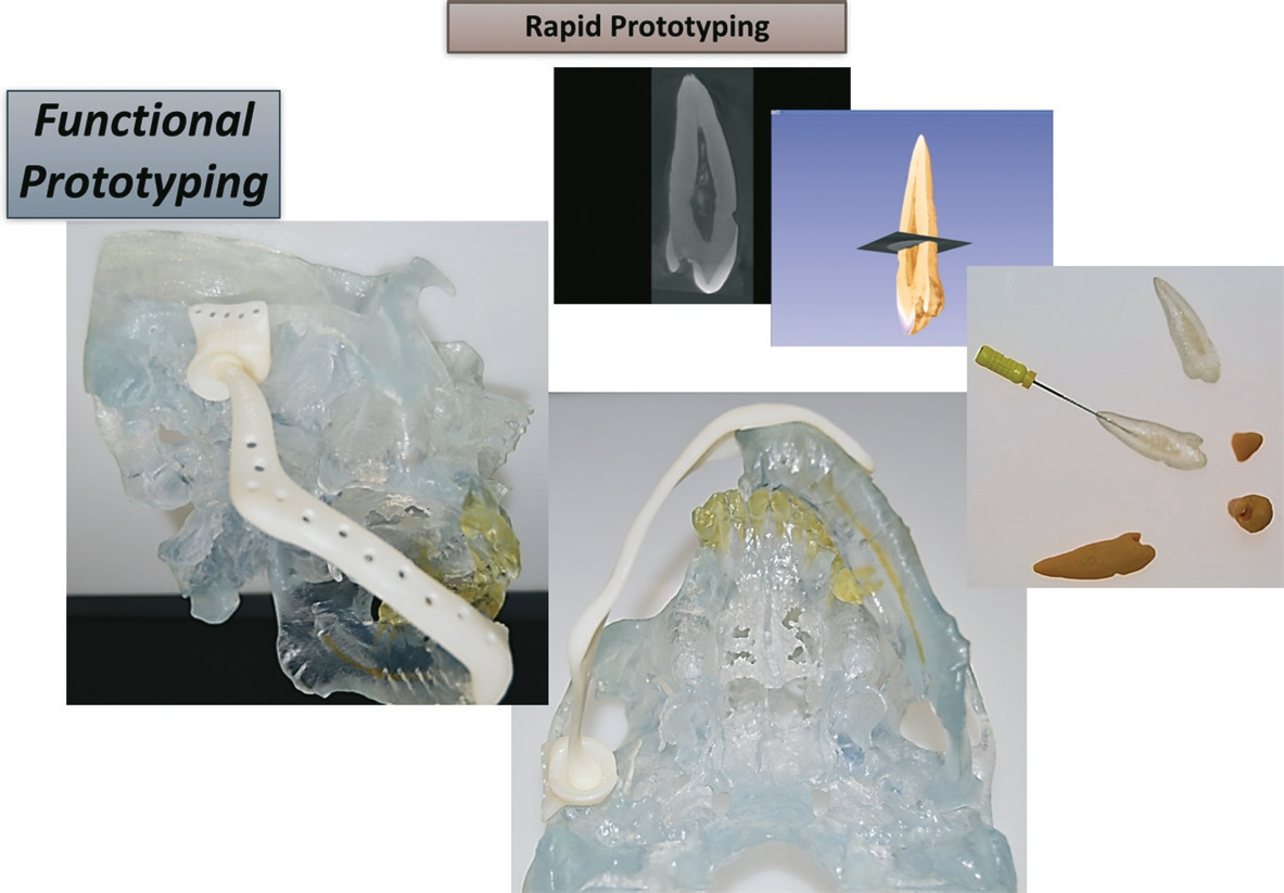 Abb. 6: Rapid Prototyping von Planungsmodellen, z. B. für die präoperative Planung, oder zur Simulation von Zahnbehandlungen, etwa in der Endodontie.