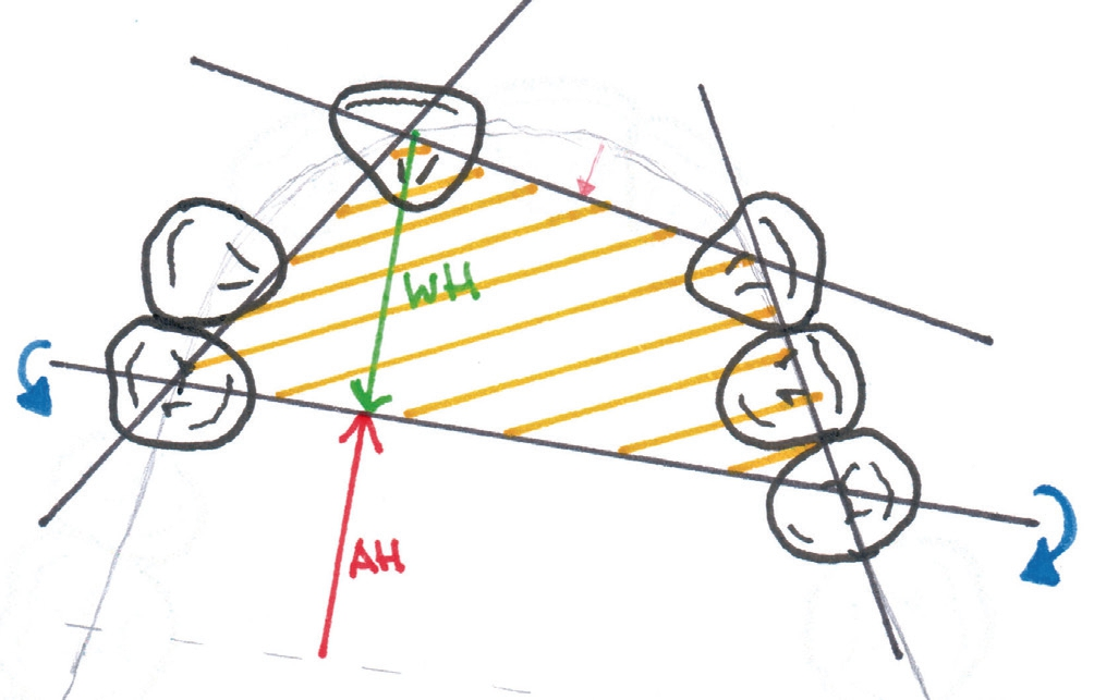 Abb. 6: Statikplanung der kombinierten Arbeit.