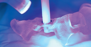 Abb. 6: Einkleben der Titanhülse nach Fertigung von CEREC Guide 3 direkt in der Praxis.
