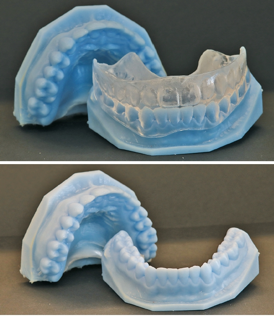Mit Freeprint® model T gedruckte Arbeitsmodelle.