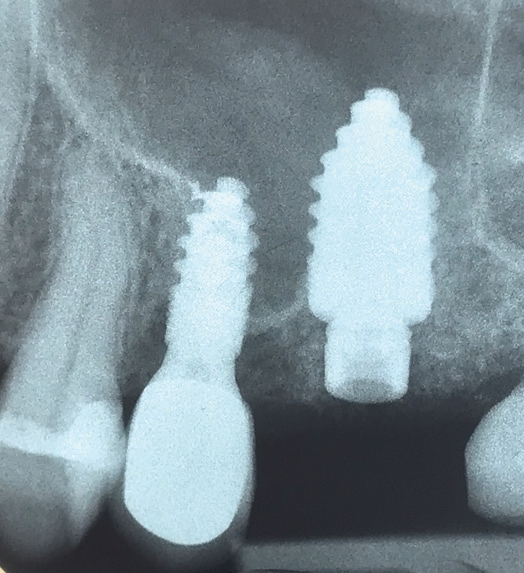 Abb. 6: Situation nach 12 Wochen.