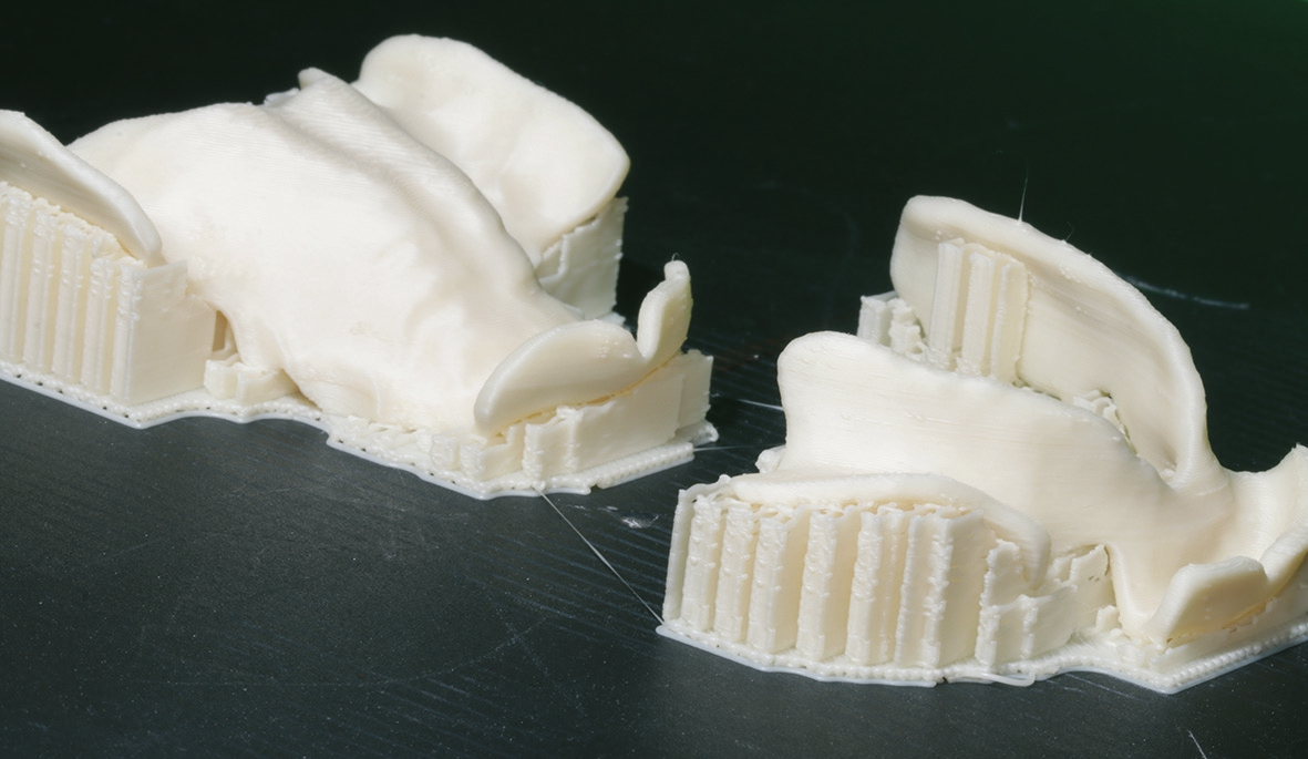 Abb. 6: Mit Filamentdrucker produzierte Bissschablonen.