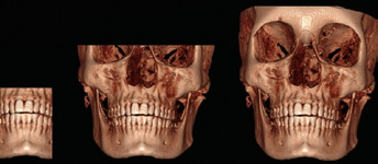 Abb. 10: DVT Volumen.