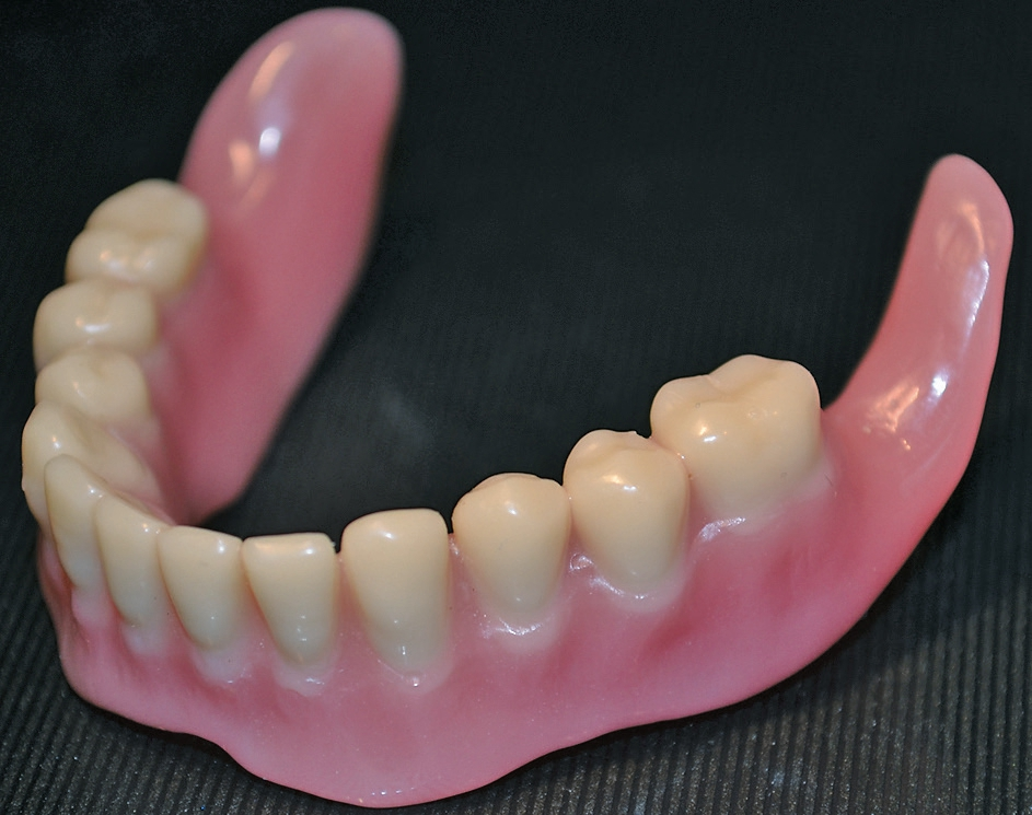 Abb. 5: Totalprothese aus dem 3D-Drucker. Das Material besitzt die Zulassung nach Klasse 2a. Zähne und Basis sind in separaten Arbeitsschritten gedruckt und zusammengefügt worden.