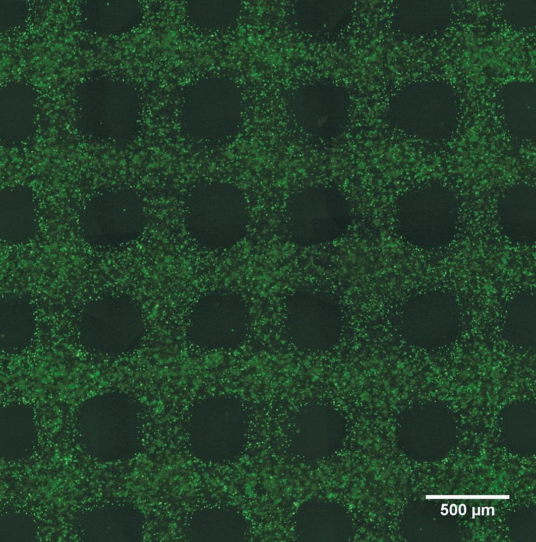 Abb. 7: Biodruck von Zellen. Im vorliegenden Bild ist jede lebende Zelle grün angefärbt. Die Zellen sind im Hydrogel homogen verteilt und lassen sich beliebig und strangweise im Scaffold anordnen.