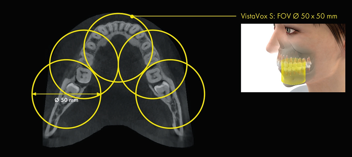 Flexible Wahl: Weitere eingegrenzte FoV-Volumen (Ø 50 x 50 mm) für die fokussierte Diagnostik.