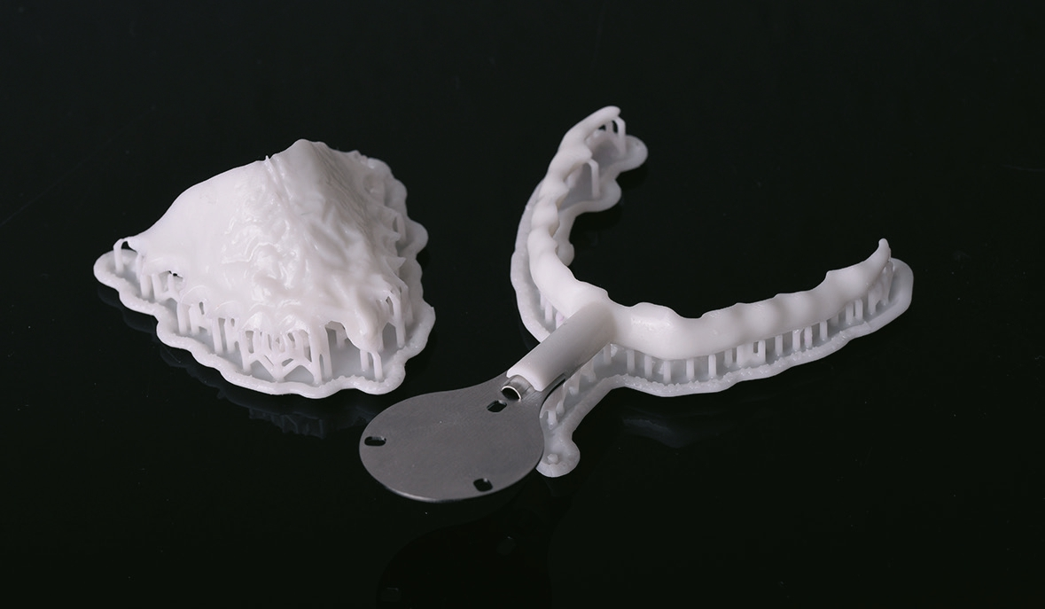 Abb. 7: Oberkiefer-Jig und paraokklusaler Löffel aus dem 3D-Drucker.