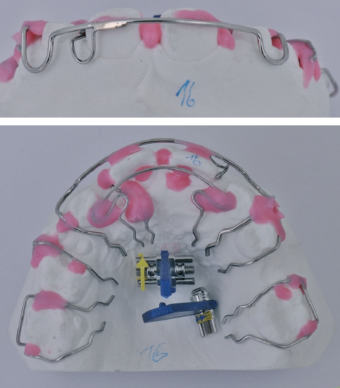 Abb. 7a u. b: Platzierung der Halte- und Funktionselemente.