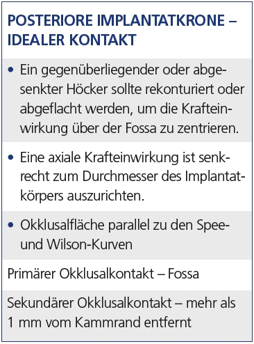 Tab. 2: Idealer Kontaktbereich.