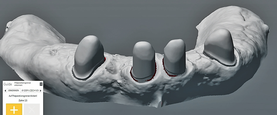 Abb. 7: Ergebnis der Oberflächenberechnung.
