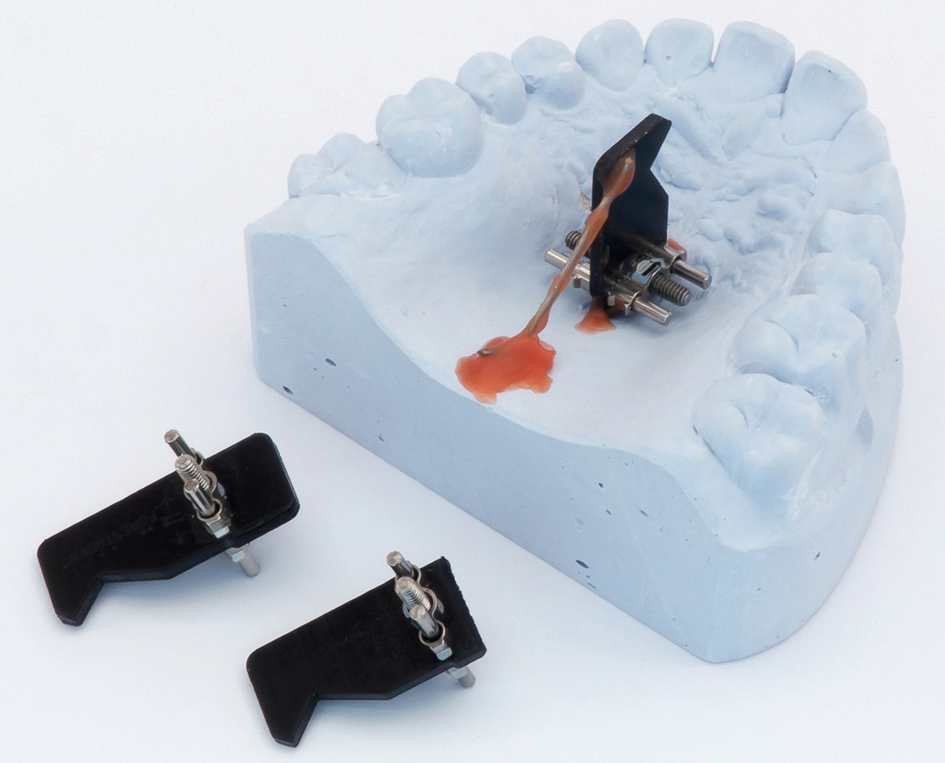 Abb. 13: Schraube mit breitem Platzhalter.