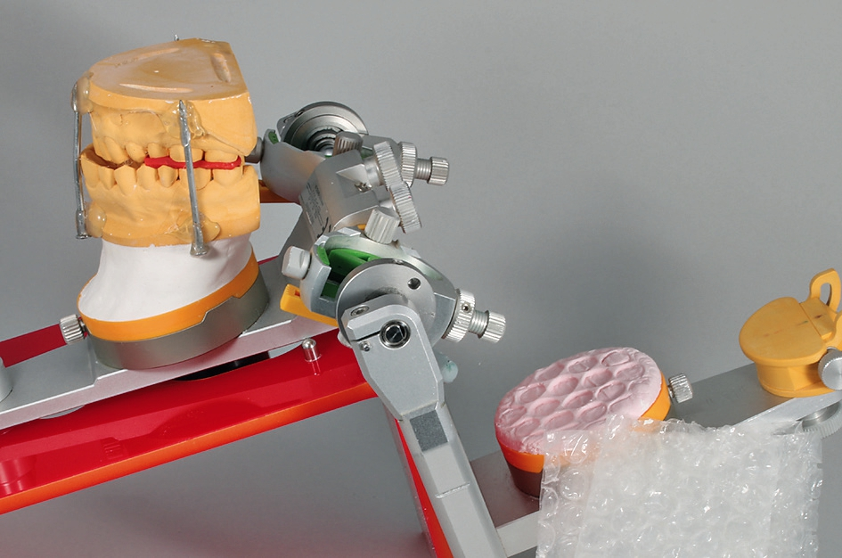 Abb. 21: „Erstmontage-Dummy“ mit Noppenfolien-Impressionen.
