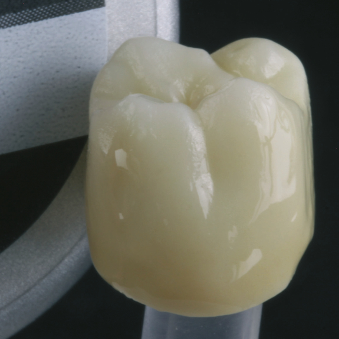 Abb. 8: Mit der Malfarbe BS-A lassen sich zervikale und interdentale Bereiche anpassen.