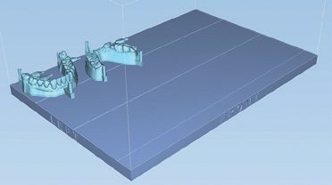Abb. 8: Platzierung des Modells auf der digitalen Bauplattform für den 3D-Druck.