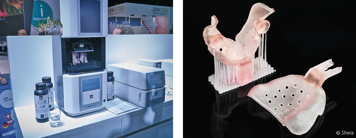 Abb. 8 u. 9: Mit Sheraeasy-base kann der Abformlöffel optimal gestaltet und auf die Abformmethode abgestimmt werden.