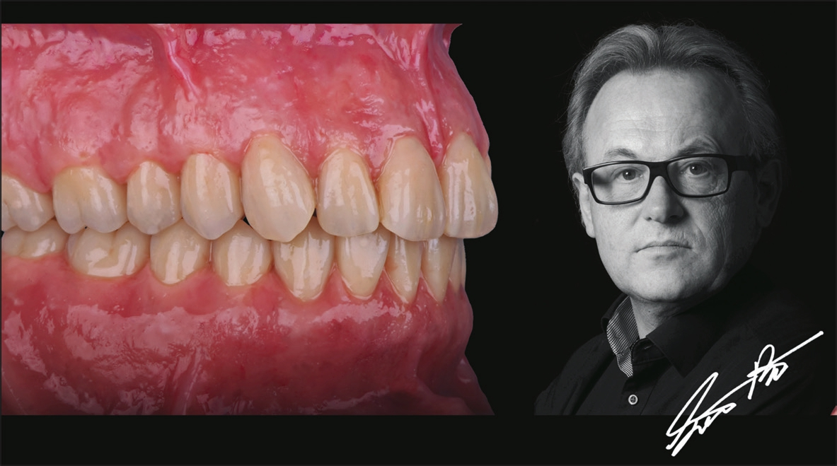 Abb. 8: Die naturnahe Nachbildung der Rot-weiß-Ästhetik macht die „ganze“ Prothetik aus und lässt sie harmonisch „wirken“ – weil Lachlinie, Zähne und Gingiva eine Einheit sind.