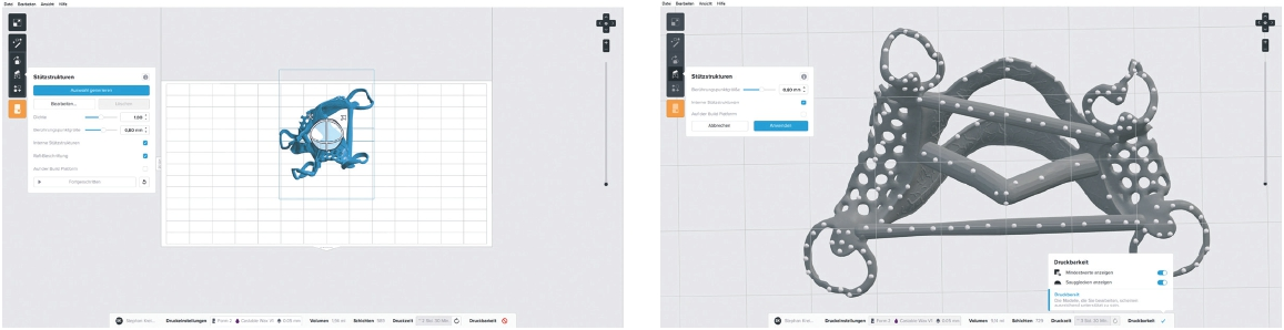 Abb. 7a u. b: Das Modellgussprothesengerüst wird in der intuitiven Formlabs PreForm Slicing-Software für den Druck vorbereitet.