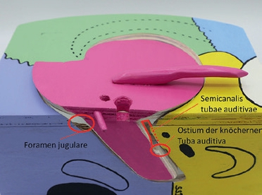Abb. 8: Innenrotation der Squama: Pars petrosa bewegt sich nach kaudal, Foramen jugulare und Tuba auditiva sind weit geöffnet.