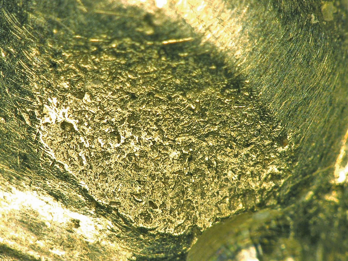 Abb. 8a: Kaufläche einer sogenannten Biolegierung nach wenigen Jahren Tragezeit.