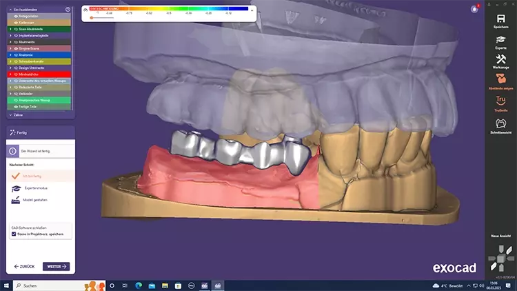 Abb. 8a: Designen des endgültigen Zahnersatzgerüstes digitalen Workflow.