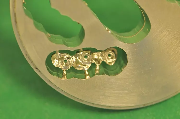 Abb. 9: Gefrästes endgültiges Gerüst.