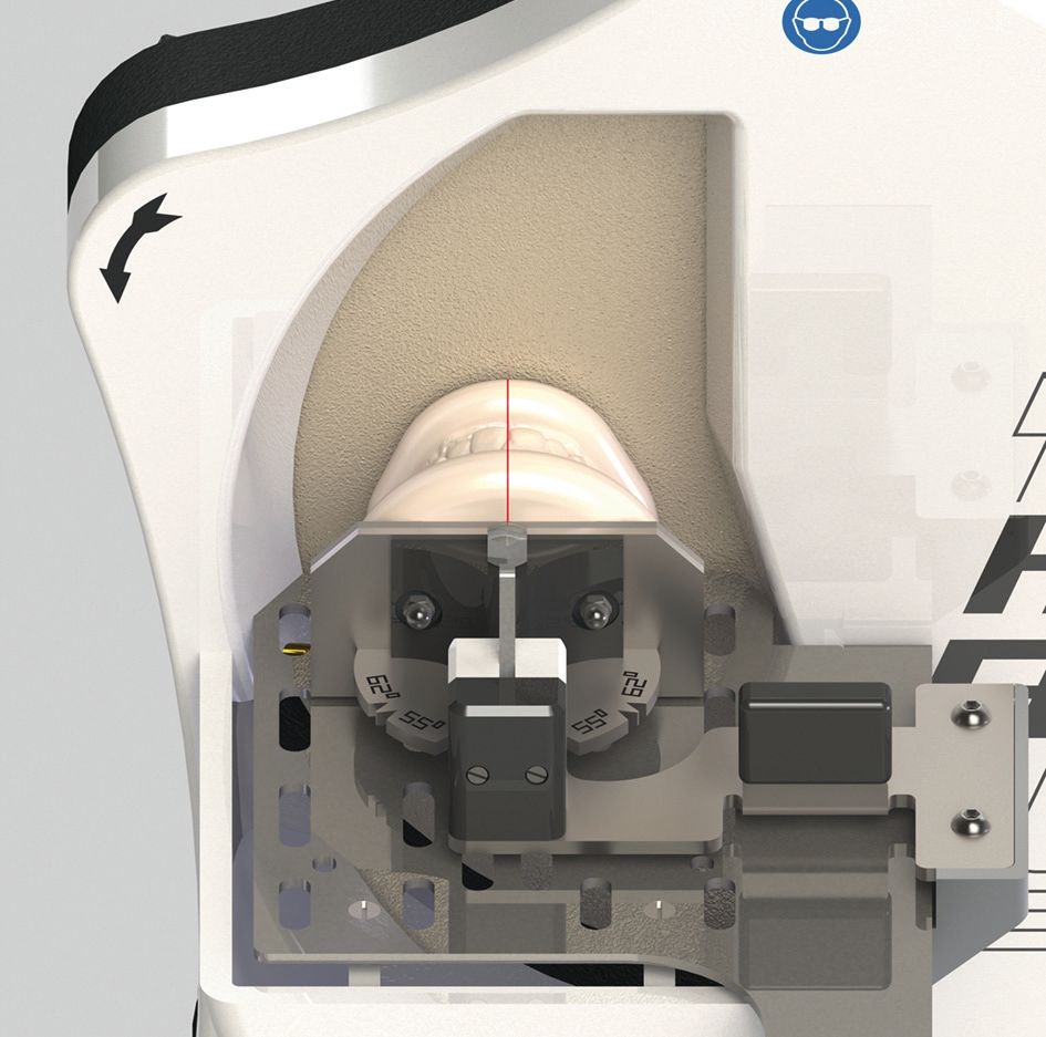 Abb. 9: Abtragen der UK-Basis bis zur gewünschten Modellhöhe.