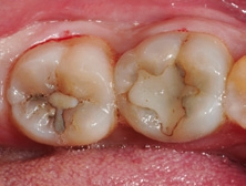 Abb. 13: Präoperative Situation.