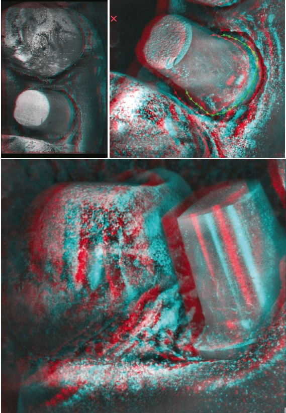 Abb. 8a–c: Rot-grüne 3D-Brille aufsetzen und dieses und die weiteren Bilder