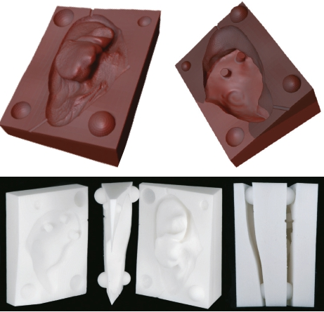Abb. 8: Rapid-Tooling-Verfahren. Oben: Virtuelles Design einer aus drei Teilen bestehenden negativen Hohlform zum Ausgießen der Epithese. Unten links: Die mittels Selektiven Lasersinter-Verfahrens (SLS) gedruckte dreigliedrige Form. Unten rechts: Beispielhaftes Zusammenfügen aller Teile, die exakt ineinander passen müssen, um formschlüssig und spaltfrei zu schließen.