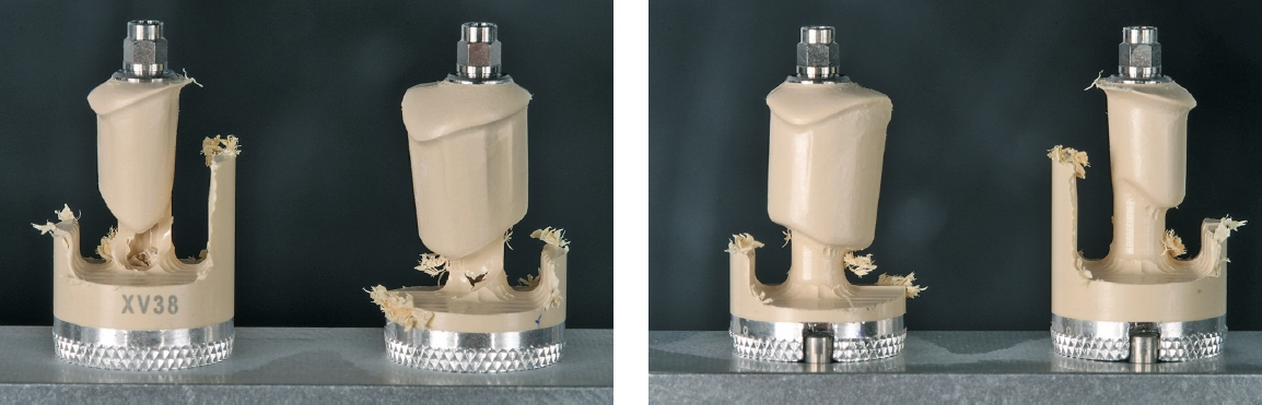 Abb. 9 u. 10: Die gefrästen One-Time-Abutments.