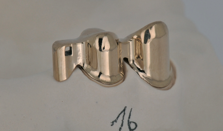 Abb. 6: Doppelkronen mit Zapfen und Riegelauge.