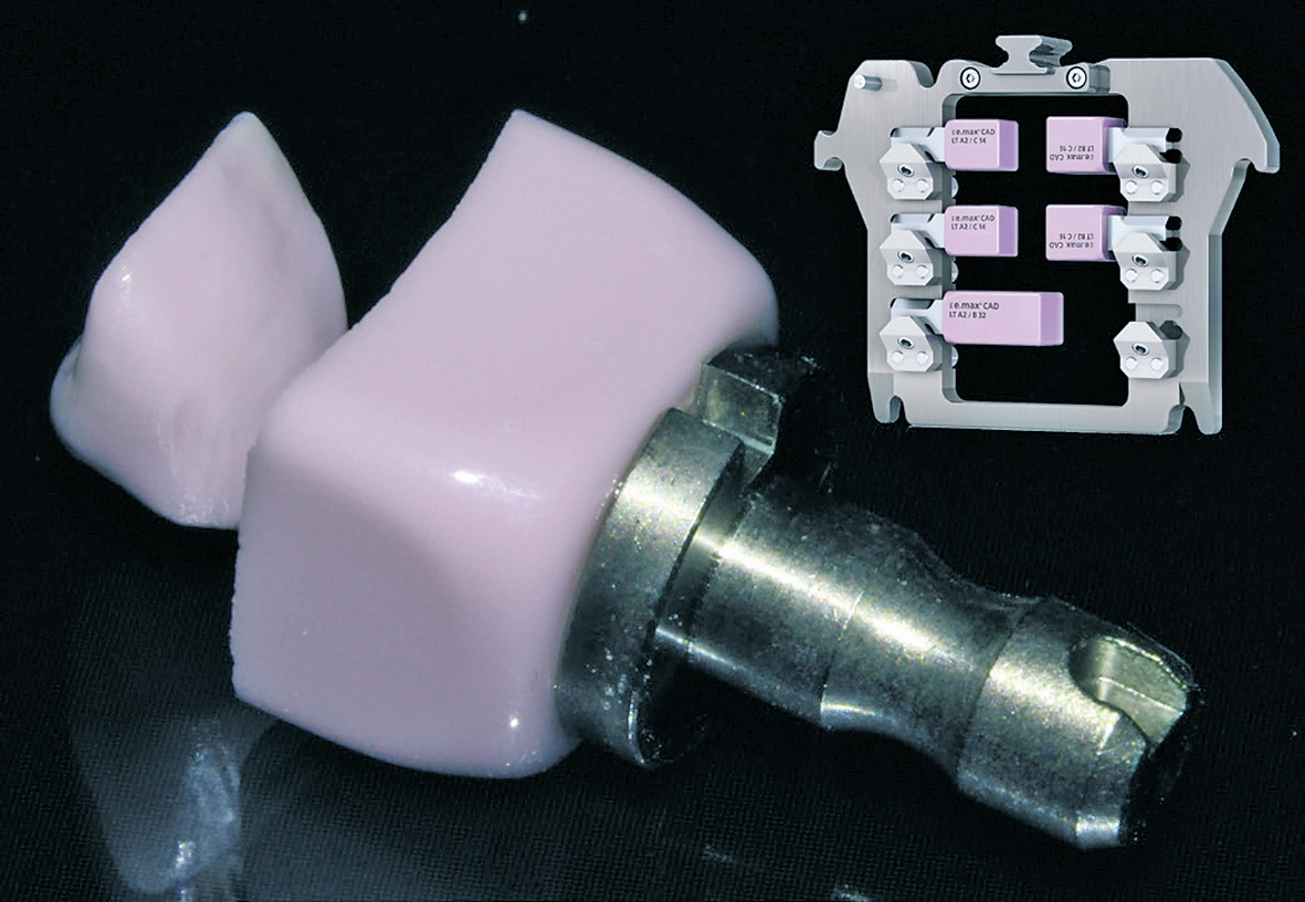 Abb. 8: Lithium-Disilikat-Block (IPS e.max CAD) im blauen, vorkristallisierten Zustand im e.matrix Multi-Holder (für die Zenotec Select-Schleifmaschine) bereit zur Nassbearbeitung.